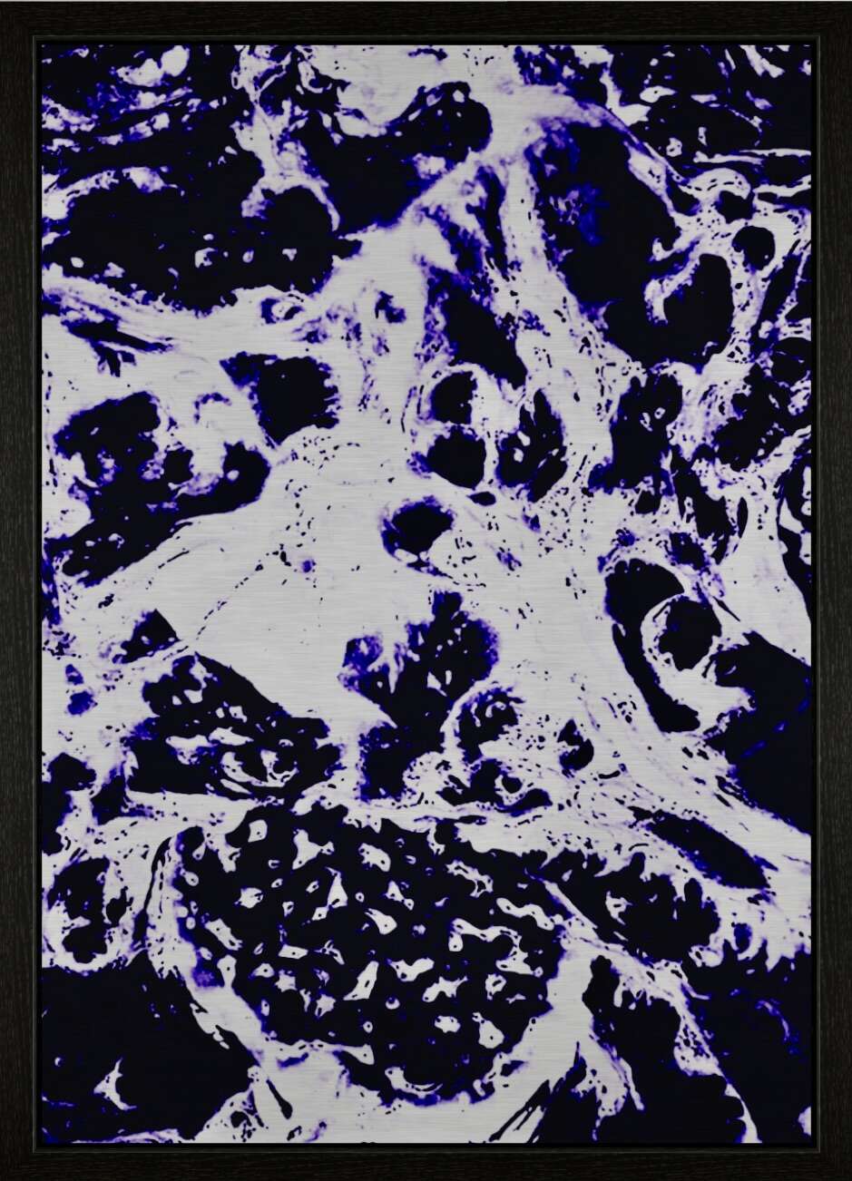 LAVA I - Emiliano Bartling 2